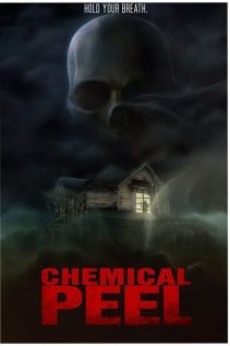 Chemical Peel 2014